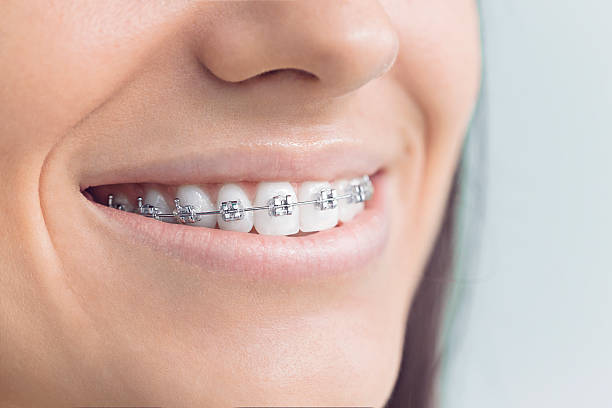 Best Dental Fillings (Composite and Amalgam)  in Greenbelt, MD